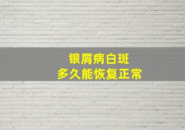 银屑病白斑 多久能恢复正常